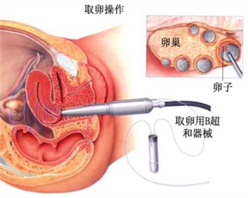 苏州借腹生子在香港合法吗,来月经前乳房痛吃什