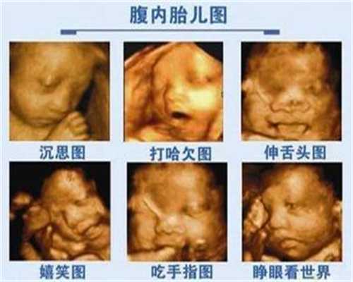 北京代孕谁做过_北京代孕男女选择
